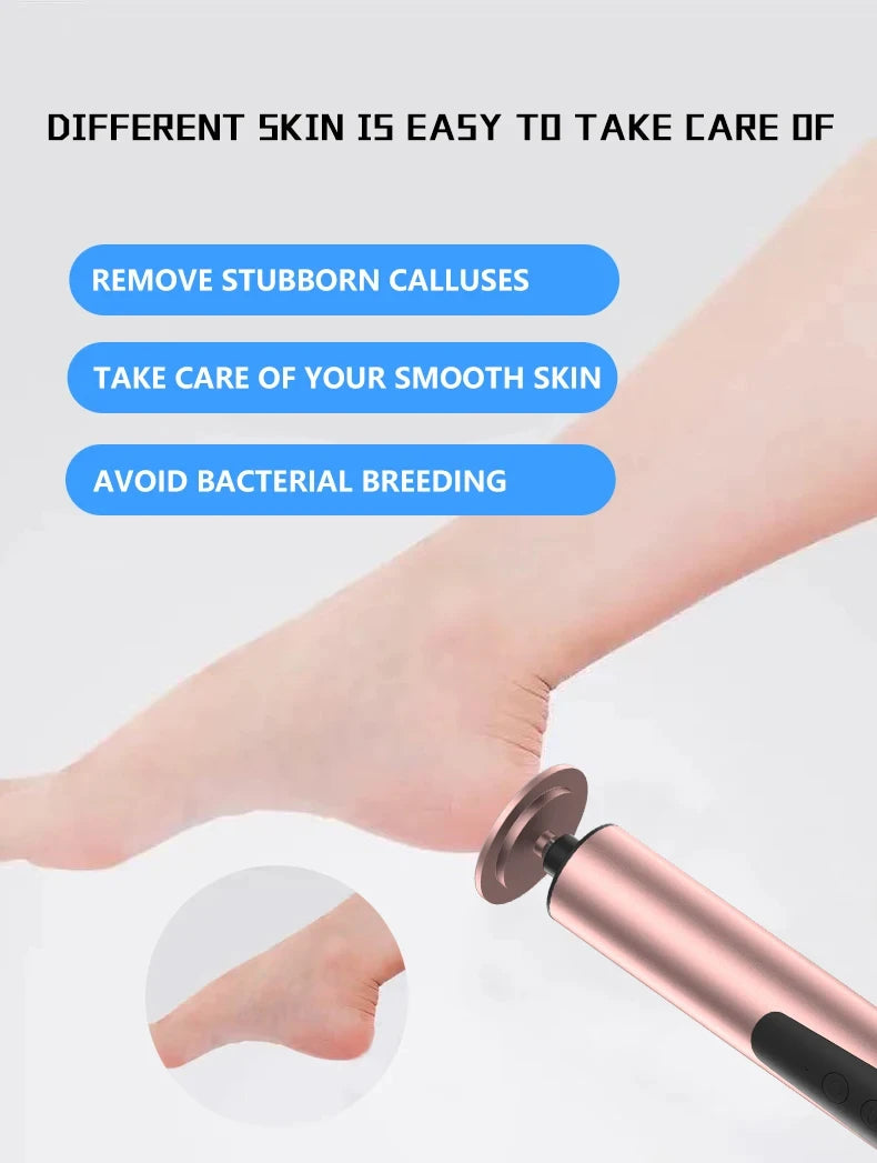 Electric Foot File Callus Remover