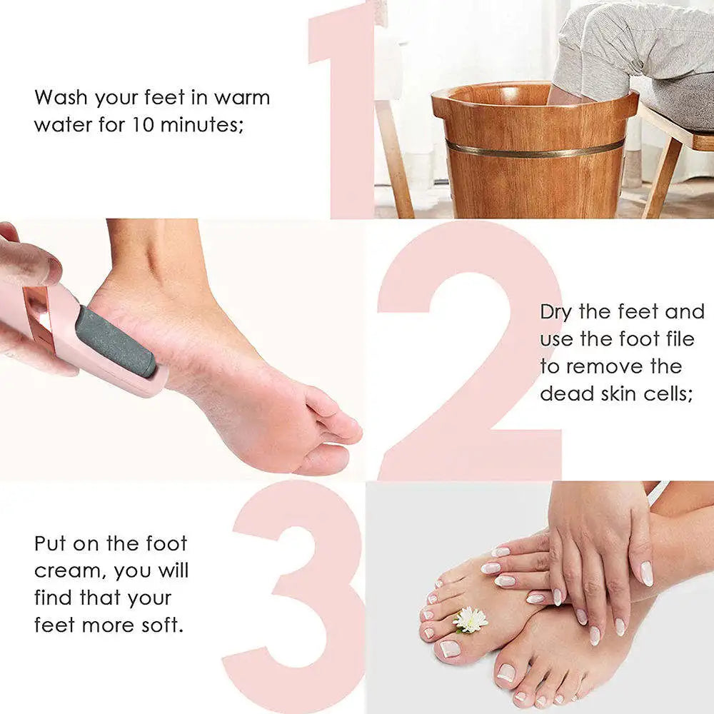 Smooth Rechargeable Callus Remover
