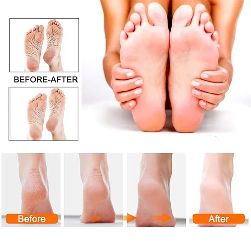 Rechargeable SmoothPro Electric Foot File
