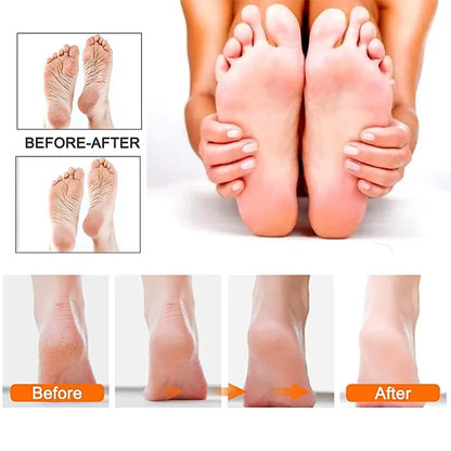 Rechargeable SmoothPro Electric Foot File