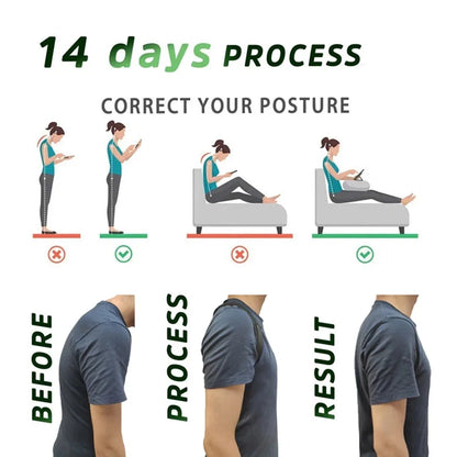 Adjustable Hunchback Posture Corrector Belt