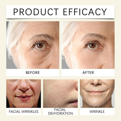 Ouhoe Snail Collagen Face Cream – 92% Mucin Repair